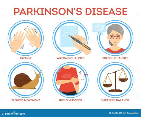 Parkinson Disease Symptoms Infographic. Idea of Dementia Stock Vector - Illustration of nervous ...