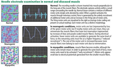 Axon Nerve Test