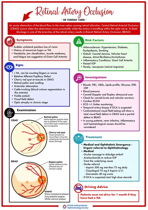 Retinal Artery Occlusion – British Undergraduate Ophthalmology Society