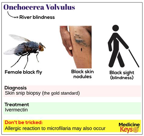 Onchocerca volvulus - Medicine Keys for MRCPs