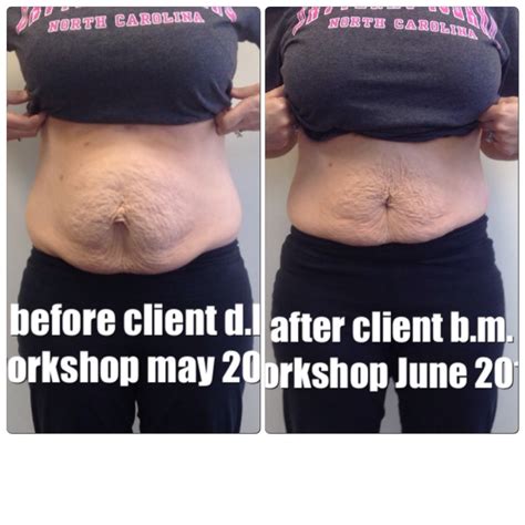 All New Before and After Pictures – Healing the Diastasis Recti 2015 – Beautiful After the Belly