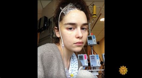 Emilia Clarke Shared Photos From Her Brain Aneurysm Recovery To Help ...