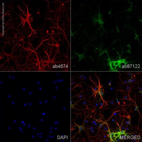 Anti-GFAP antibody (ab4674) | Abcam