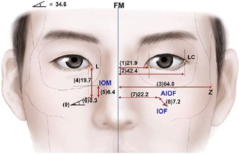 Illustration of the main vertical and horizontal parameters; IOM ...