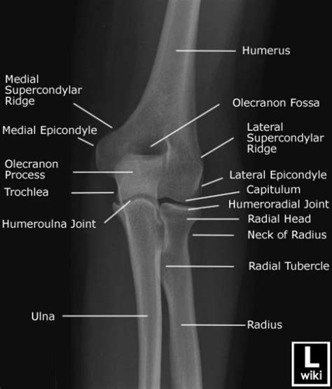 Radiology Student, Radiology Technician, Radiology Imaging, Radiology Technologist, Medical ...