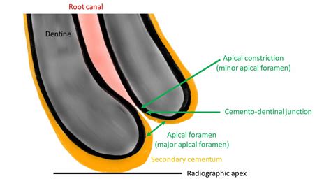 Apical Meaning Dentistry