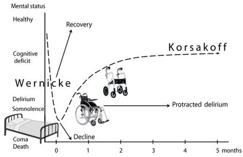 Wernicke's encephalopathy causes, symptoms, diagnosis, treatment ...