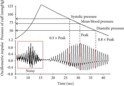 Cuff pressure waveform of oscillometric method. | Download Scientific Diagram