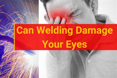 Can Welding Damage Your Eyes? Hazards & Safety Tips In 2023