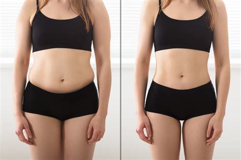 Liposuction Southern Maryland | Laser Lipo Waldorf | Mid-Atlantic Skin