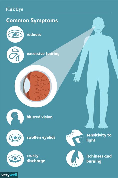 Pink Eye (Conjunctivitis): Symptoms and Complications