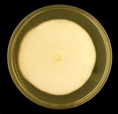 Geotrichum candidum ~ Everything You Need to Know with Photos | Videos