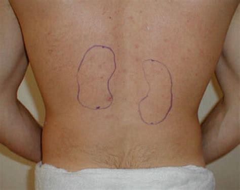 👉 Kidney Pain - (Location, anatomy), lower back, Vs Back pain, Causes, Treatment (January 2022)