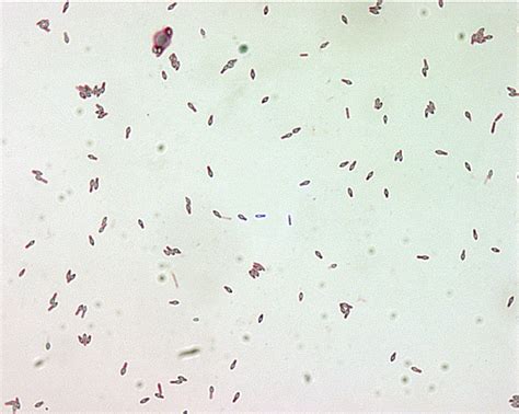 Free picture: clostridium botulinum, spores, malachite, green, stain