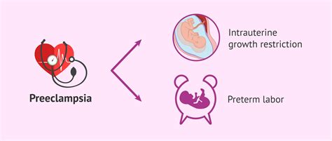 Complications Of Preeclampsia