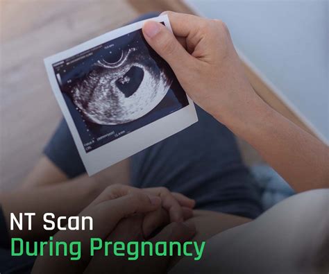 A Comprehensive Guide about NT Scan During Pregnancy in 2023