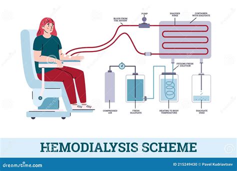 Kidney Dialysis Vector Illustration | CartoonDealer.com #44257508