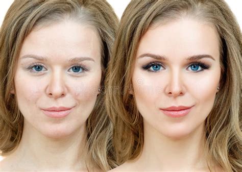 Woman with Acne before and after Treatment and Makeup. Stock Photo ...