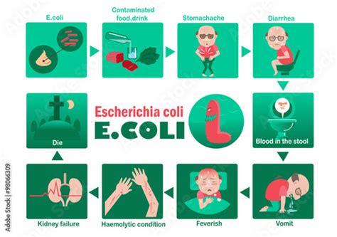 "E. coli symptom of Patients Escherichia coli Info Graphic.vector illustration." Stock image and ...