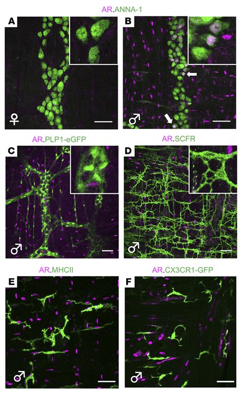 Androgen receptor expression in mouse colon. (A and B) AR... | Download ...