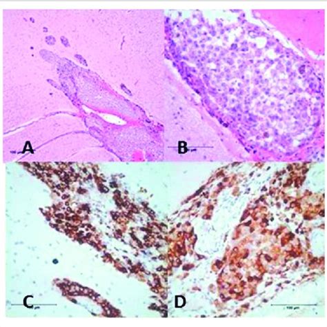 (a) Histological section of meninges and underlying brain, showing ...