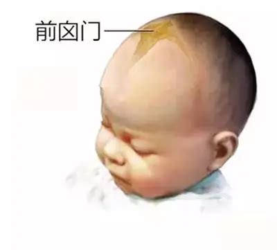 囟门，宝宝的“头”等大事，不可不注意 - 知乎