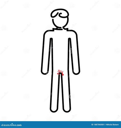 A Simple Stylized Vector Image Of A Man With A Rash In The Groin Area | CartoonDealer.com #188706008