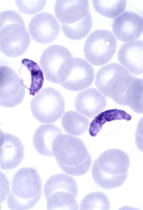 Plasmodium falciparum