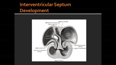 Interventricular Septum Development - YouTube