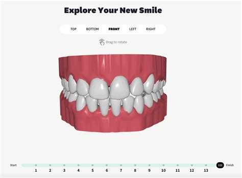 Byte Aligners 2024 Review: A Complete In-Depth Breakdown