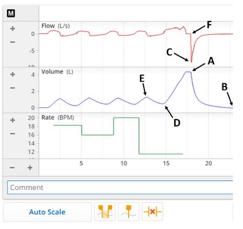 [Solved] In the figure above, to measure the inspiratory reserve volume... | Course Hero