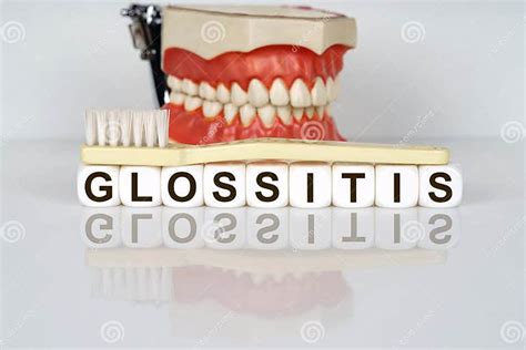 Medical, Dental Concept. the Text is Written on the Cubes - GLOSSITIS ...