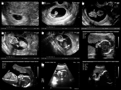 Entwicklung von Embryo/Fötus • Wachstum im Mutterleib – 9monate.de