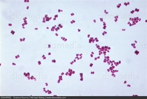 Micrococcus luteus antibiotic treatment