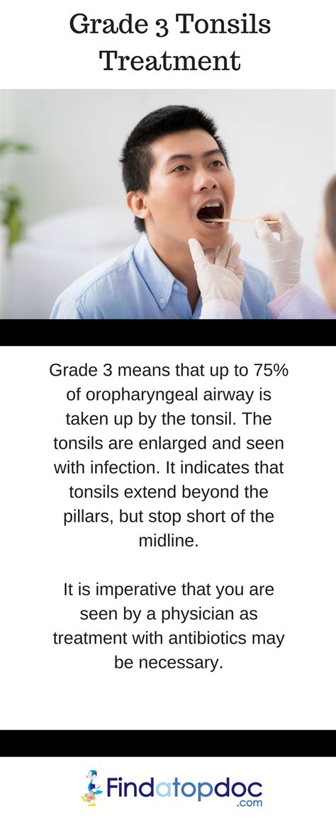 What is Tonsil Grading? Symptoms, Size, and System