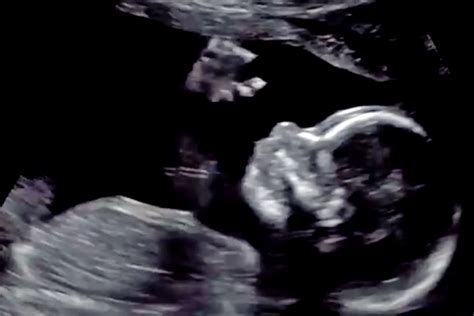 Maren Morris' Baby Boy Gives a Wave Hello in Sonogram Video