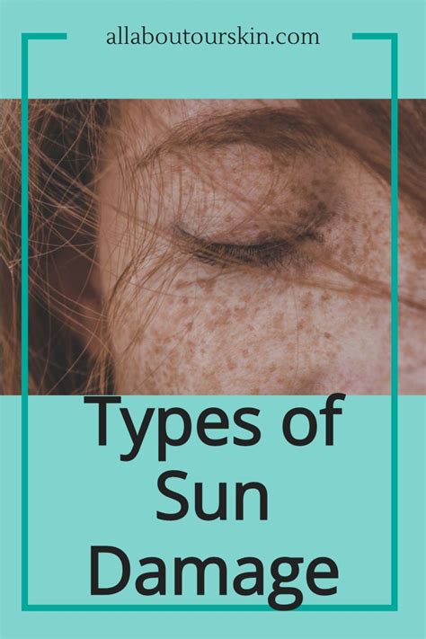 Types of Sun Damage | How to line lips, Skin cancer, Damaged hair follicles