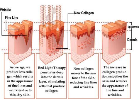 Red Light Therapy-Reduce Wrinkles, Age Spots, Acne, & More!