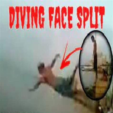 Split Face Diving Accident: Understanding What Happened - Daily Bro