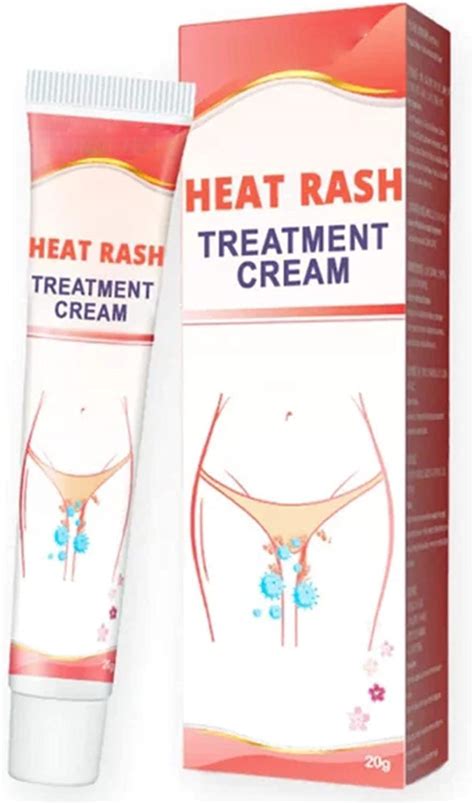 Buy Heat Cream, 20g Heat Cream, Heat Care Cream, Heat ,Fast from Sweat , Dry, Itchy, Bite ...