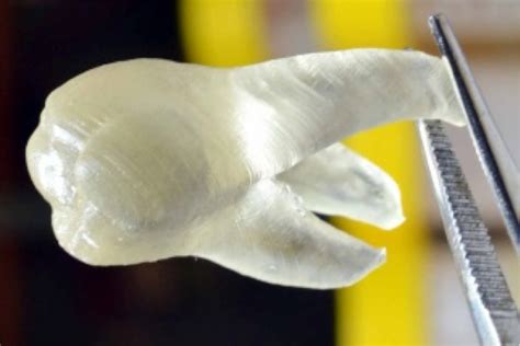 3D printed teeth to keep your mouth free of bacteria | New Scientist