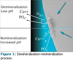 The Dynamic Process of Demineralization and Remineralization