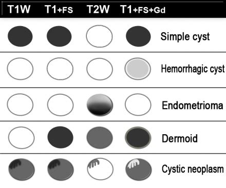 Hemorrhagic Ovarian Cyst Mri