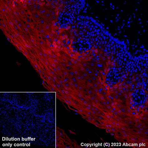 Recombinant Alexa Fluor® 647 Anti-IL-1RA antibody [EPR26853-58] (ab315955)