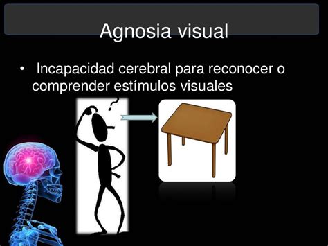 Agnosia