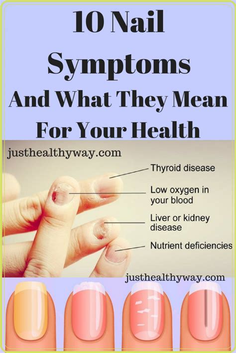 10 Nail Symptoms And What They Mean For Your Health - Just Healthy Way | Coconut health benefits ...