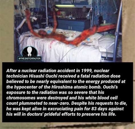 After a nuclear radiation accident in 1999, nuclear technician Hisashi Ouchi received a fatal ...