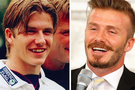 Check our David Beckhams celebrity dentistry before and after. What a dental makeover! Dynamite ...