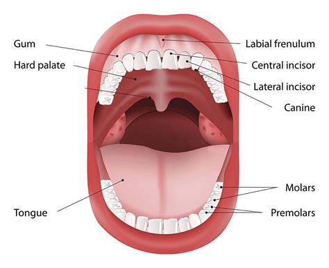 Early Stages Of Mouth Cancer From Chewing Tobacco