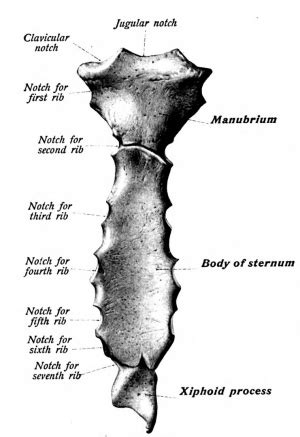 Sternal fracture - WikEM